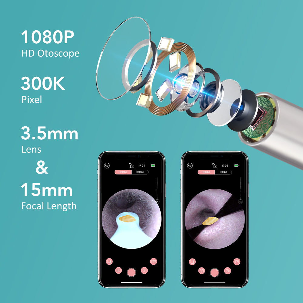 QIUGUO Wireless Visual Ear Cleaner with 1080P Camera, 360° Rotatable Lens & 6 LED Lights, Ear Spoon & Tweezer Set, WiFi for iOS Android, for Adults Kids Pets