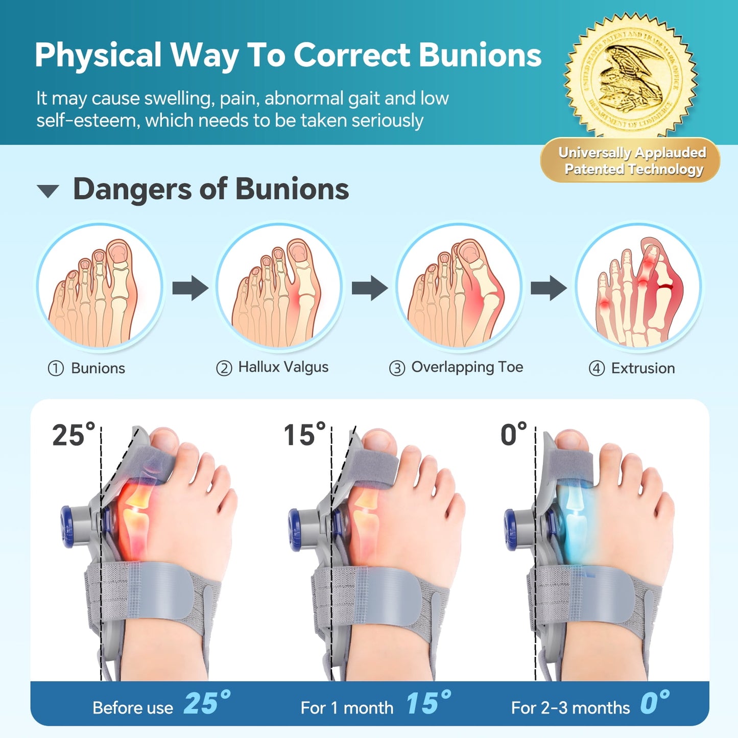 Bunion Corrector for Women Men Big Toe, Hallux Valgus Separator, Adjustable Knob Bunion Splint Straightener with Anti-slip Heel Strap and Silicone Pad for Relief, All-day and Left and Right